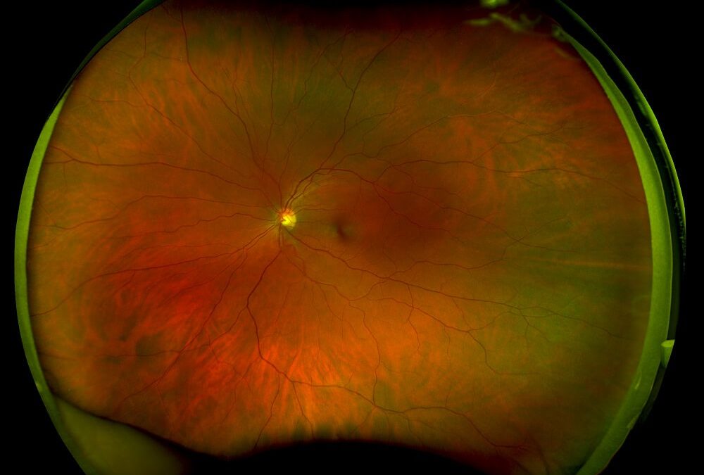 New Eye Exam Technology